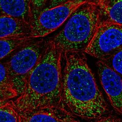 Immunocytochemistry/Immunofluorescence: CYTB Antibody [NBP2-57841] - Staining of human cell line MCF7 shows localization to mitochondria.