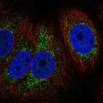 Immunocytochemistry/Immunofluorescence: CYTB Antibody [NBP3-17828] - Staining of human cell line MCF7 shows localization to mitochondria.