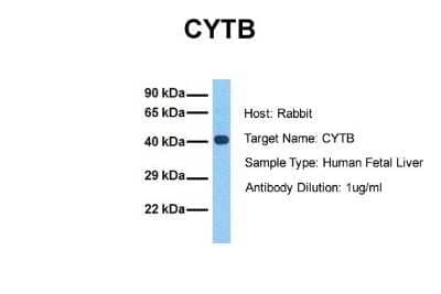 Western Blot: CYTB Antibody [NBP1-79340] - Sample Tissue: Human Fetal Liver Antibody Dilution: 1.0 ug/ml