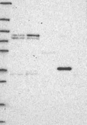 Western Blot: CYTB Antibody [NBP3-17828] - Lane 1: Marker [kDa] 250, 130, 95, 72, 55, 36, 28, 17, 10;   Lane 2: RT4;   Lane 3: U-251 MG;   Lane 4: Human Plasma;   Lane 5: Liver;   Lane 6: Tonsil