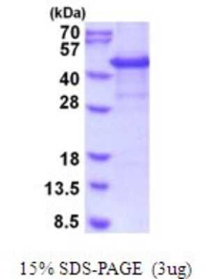 SDS-Page: CYTIP Recombinant Protein [NBP2-51974] - 15% SDS Page (3 ug)