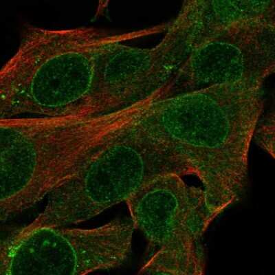 Immunocytochemistry/ Immunofluorescence CYTL1 Antibody