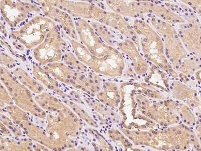 Immunohistochemistry-Paraffin CYYR1 Antibody - BSA Free