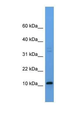 Western Blot: CYYR1 Antibody [NBP1-68916] - Rat Brain lysate, concentration 0.2-1 ug/ml.