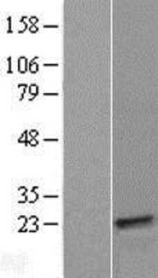 Western Blot: CYorf15A Overexpression Lysate (Adult Normal) [NBP2-08852] Left-Empty vector transfected control cell lysate (HEK293 cell lysate); Right -Over-expression Lysate for CYorf15A.