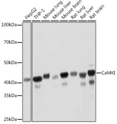 Western Blot CaM Kinase I Antibody (4P4K9)