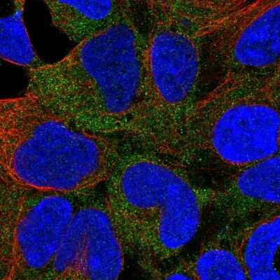 Immunocytochemistry/ Immunofluorescence CaM Kinase I Antibody