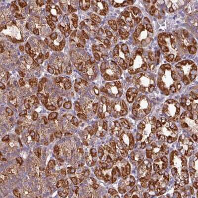 Immunohistochemistry: CaM Kinase I Antibody [NBP2-38647] - Staining of human stomach, upper shows strong cytoplasmic positivity in glandular cells.