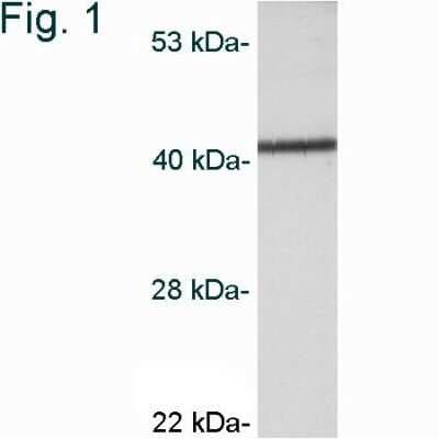 Western Blot: CaM Kinase I Antibody [NB600-1163] - Analysis of AtT20 cell extract.