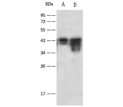 Western Blot: CaM Kinase I Antibody [NBP2-99439] - Anti-CaM Kinase I rabbit polyclonal antibody at 1:10000 dilution. Lane A: HepG2 Whole Cell Lysate. Lane B: Mouse brain tissue lysate. Lysates/proteins at 30 ug per lane. Secondary Goat Anti-Rabbit IgG (H+L)/HRP at 1/10000 dilution. Developed using the ECL technique. Performed under reducing conditions. Predicted band size: 41 kDa. Observed band size: 44 kDa