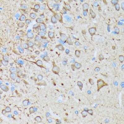 Immunohistochemistry-Paraffin: CaM Kinase II Antibody (9P2E2) [NBP3-15256] - Immunohistochemistry of paraffin-embedded rat brain using CaM Kinase II Rabbit mAb (NBP3-15256) at dilution of 1:100 (40x lens).Perform microwave antigen retrieval with 10 mM Tris/EDTA buffer pH 9.0 before commencing with IHC staining protocol.