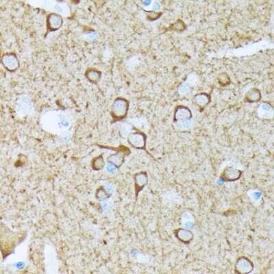 Immunohistochemistry-Paraffin: CaM Kinase II Antibody (9P2E2) [NBP3-15256] - Immunohistochemistry of paraffin-embedded human brain using CaM Kinase II Rabbit mAb (NBP3-15256) at dilution of 1:100 (40x lens).Perform microwave antigen retrieval with 10 mM Tris/EDTA buffer pH 9.0 before commencing with IHC staining protocol.