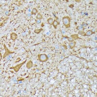 Immunohistochemistry-Paraffin: CaM Kinase II Antibody (9P2E2) [NBP3-15256] - Immunohistochemistry of paraffin-embedded mouse spinal cord using CaM Kinase II Rabbit mAb (NBP3-15256) at dilution of 1:100 (40x lens).Perform microwave antigen retrieval with 10 mM Tris/EDTA buffer pH 9.0 before commencing with IHC staining protocol.