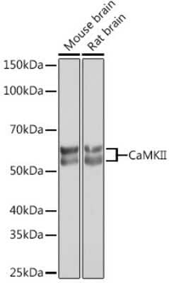 Western Blot: CaM Kinase II Antibody (9P2E2) [NBP3-15256] - Western blot analysis of extracts of various cell lines, using CaM Kinase II Rabbit mAb (NBP3-15256) at 1:1000 dilution. Secondary antibody: HRP Goat Anti-Rabbit IgG (H+L) at 1:10000 dilution. Lysates/proteins: 25ug per lane. Blocking buffer: 3% nonfat dry milk in TBST. Detection: ECL Basic Kit. Exposure time: 5s.