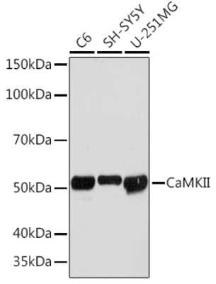 Western Blot: CaM Kinase II Antibody (9P2E2) [NBP3-15256] - Western blot analysis of extracts of various cell lines, using CaM Kinase II Rabbit mAb (NBP3-15256) at 1:1000 dilution. Secondary antibody: HRP Goat Anti-Rabbit IgG (H+L) at 1:10000 dilution. Lysates/proteins: 25ug per lane. Blocking buffer: 3% nonfat dry milk in TBST. Detection: ECL Basic Kit. Exposure time: 90s.