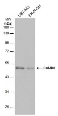 Western Blot: CaM Kinase II Antibody (GT4811) [NBP3-13508] - Various whole cell extracts (30 ug) were separated by 10% SDS-PAGE, and the membrane was blotted with CaM Kinase II antibody (NBP3-13508) diluted at 1:500. The HRP-conjugated anti-mouse IgG antibody (NBP2-19382) was used to detect the primary antibody.