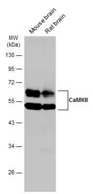 Western Blot: CaM Kinase II Antibody (GT4811) [NBP3-13508] - Various tissue extracts (50 ug) were separated by 10% SDS-PAGE, and the membrane was blotted with CaM Kinase II antibody (NBP3-13508) diluted at 1:500. The HRP-conjugated anti-mouse IgG antibody (NBP2-19382) was used to detect the primary antibody.