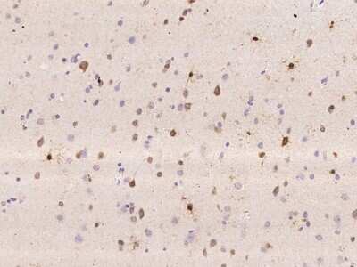 Immunohistochemistry: CaM Kinase II Antibody [NBP3-06632] - Immunochemical staining of human CAMK2B in human brain with NBP3-06632 at 1:200 dilution, formalin-fixed paraffin embedded sections.