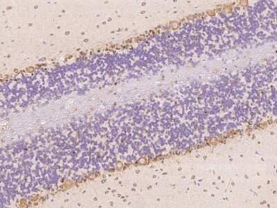 Immunohistochemistry: CaM Kinase II Antibody [NBP3-06632] - Immunohistochemical staining of human CAMK2B in cynomolgus cerebellum with NBP3-06632 at 1:200 dilution, formalin-fixed paraffin embedded sections.