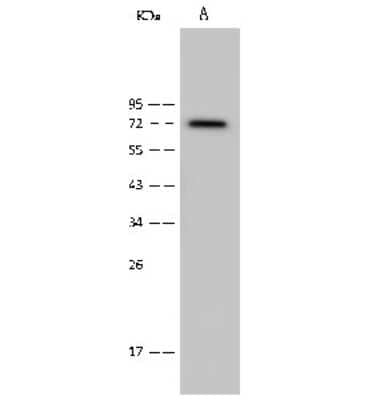 Western Blot: CaM Kinase II Antibody [NBP2-99353] - Anti-CaM Kinase II rabbit polyclonal antibody at 1:500 dilution. Lane A: MOLT4 Whole Cell Lysate. Lysates/proteins at 30 ug per lane. Secondary Goat Anti-Rabbit IgG (H+L)/HRP at 1/10000 dilution. Developed using the ECL technique. Performed under reducing conditions. Predicted band size: 72 kDa. Observed band size: 72 kDa