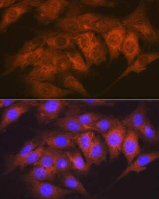 Immunocytochemistry/Immunofluorescence: CaM Kinase II delta Antibody (10M1P2) [NBP3-16783] - Immunofluorescence analysis of C6 cells using CaM Kinase II delta Rabbit mAb (NBP3-16783) at dilution of 1:100 (40x lens). Blue: DAPI for nuclear staining.