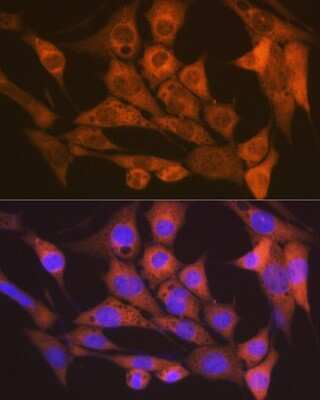 Immunocytochemistry/Immunofluorescence: CaM Kinase II delta Antibody (10M1P2) [NBP3-16783] - Immunofluorescence analysis of NIH-3T3 cells using CaM Kinase II delta Rabbit mAb (NBP3-16783) at dilution of 1:100 (40x lens). Blue: DAPI for nuclear staining.