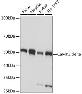 Western Blot: CaM Kinase II delta Antibody (10M1P2) [NBP3-16783] - Western blot analysis of extracts of various cell lines, using CaM Kinase II delta Rabbit mAb (NBP3-16783) at 1:1000 dilution. Secondary antibody: HRP Goat Anti-Rabbit IgG (H+L) at 1:10000 dilution. Lysates/proteins: 25ug per lane. Blocking buffer: 3% nonfat dry milk in TBST. Detection: ECL Basic Kit. Exposure time: 10s.