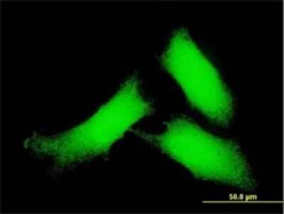 Immunocytochemistry/Immunofluorescence: CaM Kinase II delta Antibody (2E1) [H00000817-M01] - Analysis of monoclonal antibody to CAMK2D on HeLa cell . Antibody concentration 10 ug/ml.