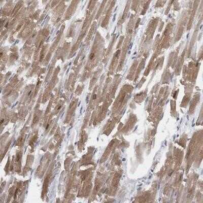 Immunohistochemistry-Paraffin: CaM Kinase II delta Antibody [NBP1-88211] - Staining of human heart muscle shows moderate cytoplasmic and nuclear positivity in myocytes.