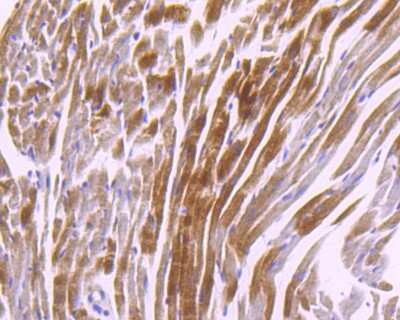 Immunohistochemistry-Paraffin: CaM Kinase II delta Antibody (JA30-07) [NBP2-67210] - Analysis of paraffin-embedded mouse heart tissue using anti-CaMKII delta antibody. Counter stained with hematoxylin.