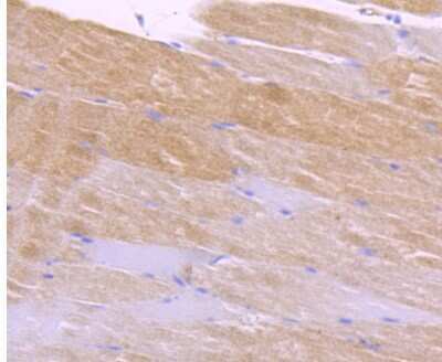 Immunohistochemistry-Paraffin: CaM Kinase II delta Antibody (JA30-07) [NBP2-67210] - Analysis of paraffin-embedded mouse skeletal muscle tissue using anti-CaMKII delta antibody. Counter stained with hematoxylin.