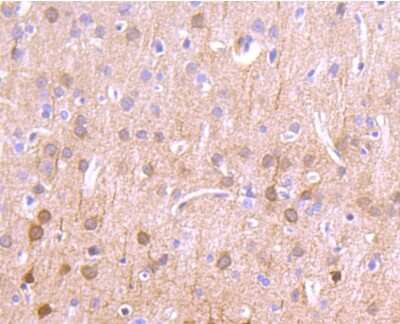 Immunohistochemistry-Paraffin: CaM Kinase II delta Antibody (JA30-07) [NBP2-67210] - Analysis of paraffin-embedded rat brain tissue using anti-CaMKII delta antibody. Counter stained with hematoxylin.