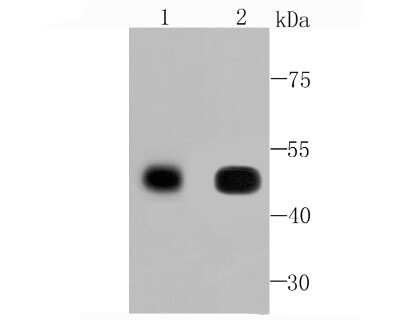 Western Blot: CaM Kinase II delta Antibody (JA30-07) [NBP2-67210] - Analysis of CaMKII delta on Human skeletal muscle (1) and Rat heart (2) tissue lysates using anti-CaMKII delta antibody at 1/500 dilution.