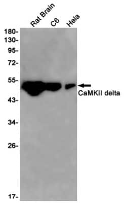 Western Blot: CaM Kinase II delta Antibody (S03-8A9) [NBP3-14913] - Western blot detection of CaM Kinase II delta in Rat Brain, C6, Hela cell lysates using CaM Kinase II delta Rabbit mAb (1:1000 diluted). Predicted band size: 56kDa. Observed band size: 56kDa.