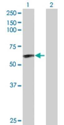 Western Blot: CaM Kinase II delta Antibody [H00000817-D01P] - Analysis of CAMK2D expression in transfected 293T cell line by CAMK2D polyclonal antibody.Lane 1: CAMK2D transfected lysate(54.10 KDa).Lane 2: Non-transfected lysate.