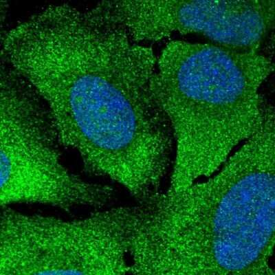 Immunocytochemistry/Immunofluorescence: CaM Kinase II gamma Antibody [NBP2-57797] - Staining of human cell line U-2 OS shows localization to plasma membrane & cytosol.