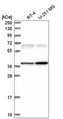 Western Blot: CaM Kinase II gamma Antibody [NBP2-57797] - Analysis in human cell line RT-4 and human cell line U-251 MG.
