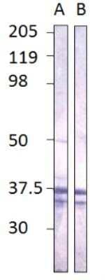 Western Blot CaM Kinase II gamma Antibody