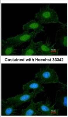 Immunocytochemistry/Immunofluorescence: CaMKI Antibody [NBP2-15683] - Immunofluorescence analysis of methanol-fixed HeLa, using antibody at 1:200 dilution.