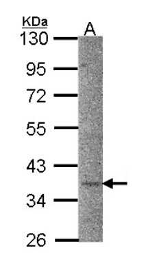 Western Blot: CaMKI Antibody [NBP2-15683] - Sample (30 ug of whole cell lysate) A: Hep G2 10% SDS PAGE gel, diluted at 1:1000.