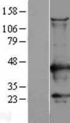 Western Blot CaM Kinase I Overexpression Lysate