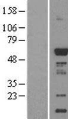 Western Blot: CaMKI gamma Overexpression Lysate (Adult Normal) [NBL1-08660] Left-Empty vector transfected control cell lysate (HEK293 cell lysate); Right -Over-expression Lysate for CaMKI gamma.