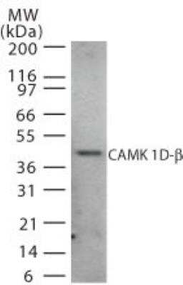 Western Blot: CAMKID Antibody [NB120-22043] - Analysis of CAMK 1D-beta in human brain cell lysate using this antibody at 2 ug/ml.