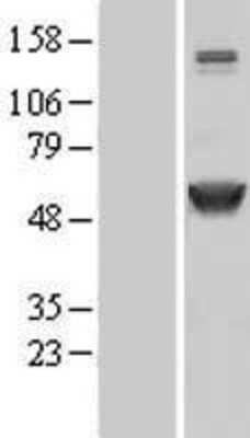 Western Blot CaM Kinase II alpha Overexpression Lysate