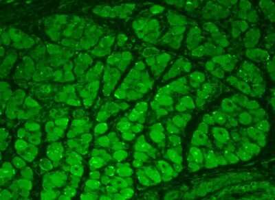 Immunohistochemistry: CaMKII alpha/beta [p Thr286, p Thr287] Antibody (22B1) [NB110-96869] - Immunohistochemistry analysis using Mouse Anti-CaMKII alpha/beta Monoclonal Antibody, Clone 22B1 (NB110-96869). Tissue: backskin. Species: Mouse. Fixation: Bouin's Fixative and paraffin-embedded. Primary Antibody: Mouse Anti-CaMKII alpha/beta Monoclonal Antibody (NB110-96869) at 1:100 for 1 hour at RT. Secondary Antibody: FITC Goat Anti-Mouse (green) at 1:50 for 1 hour at RT. Localization: Muscle, hair follicle, epidermis. Backskin obtained from transgenic mice.