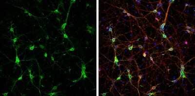 Immunocytochemistry/Immunofluorescence: CaMKII beta Antibody [NBP3-13157] - CaMKII beta antibody detects CaMKII beta protein at cytoplasm by immunofluorescent analysis. Sample: DIV9 rat E18 primary cortical neurons were fixed in 4% paraformaldehyde at RT for 15 min. Green: CaMKII beta protein stained by CaMKII beta antibody (NBP3-13157) diluted at 1:500. Red: beta Tubulin 3/ Tuj1, stained by beta Tubulin 3/ Tuj1 antibody [GT11710] (NBP2-43559) diluted at 1:500. Blue: Fluoroshield with DAPI.