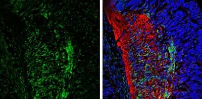 Immunohistochemistry-Frozen: CaMKII beta Antibody [NBP3-13157] - CaMKII beta antibody detects CaMKII beta protein expression by immunohistochemical analysis. Sample: Frozen sectioned E13.5 Rat brain. Green: CaMKII beta protein stained by CaMKII beta antibody (NBP3-13157) diluted at 1:250. Red: beta Tubulin 3/ TUJ1, a mature neuron marker, stained by beta Tubulin 3/ TUJ1 antibody [GT11710] (NBP2-43559) diluted at 1:500. Blue: Fluoroshield with DAPI.