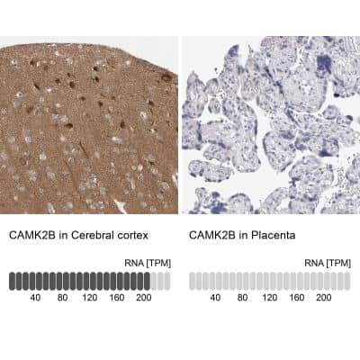 Immunohistochemistry-Paraffin: CaMKII beta Antibody [NBP1-88212] - Analysis in human cerebral cortex and placenta tissues. Corresponding RNA-seq data are presented for the same tissues