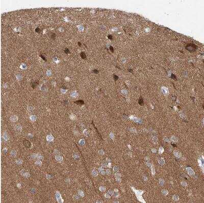 Immunohistochemistry-Paraffin: CaMKII beta Antibody [NBP1-88212] - Staining of human cerebral cortex shows moderate to strong cytoplasmic positivity in neurons.