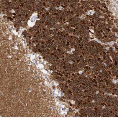 Immunohistochemistry-Paraffin: CaMKII beta Antibody [NBP1-88212] - Staining of human cerebellum shows moderate to strong cytoplasmic positivity in Purkinje cells